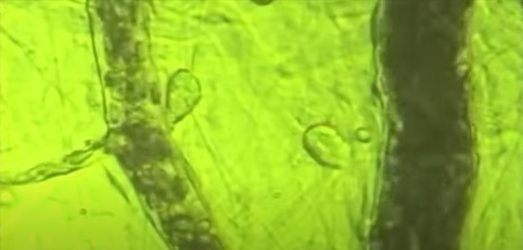 Blood Flow video image